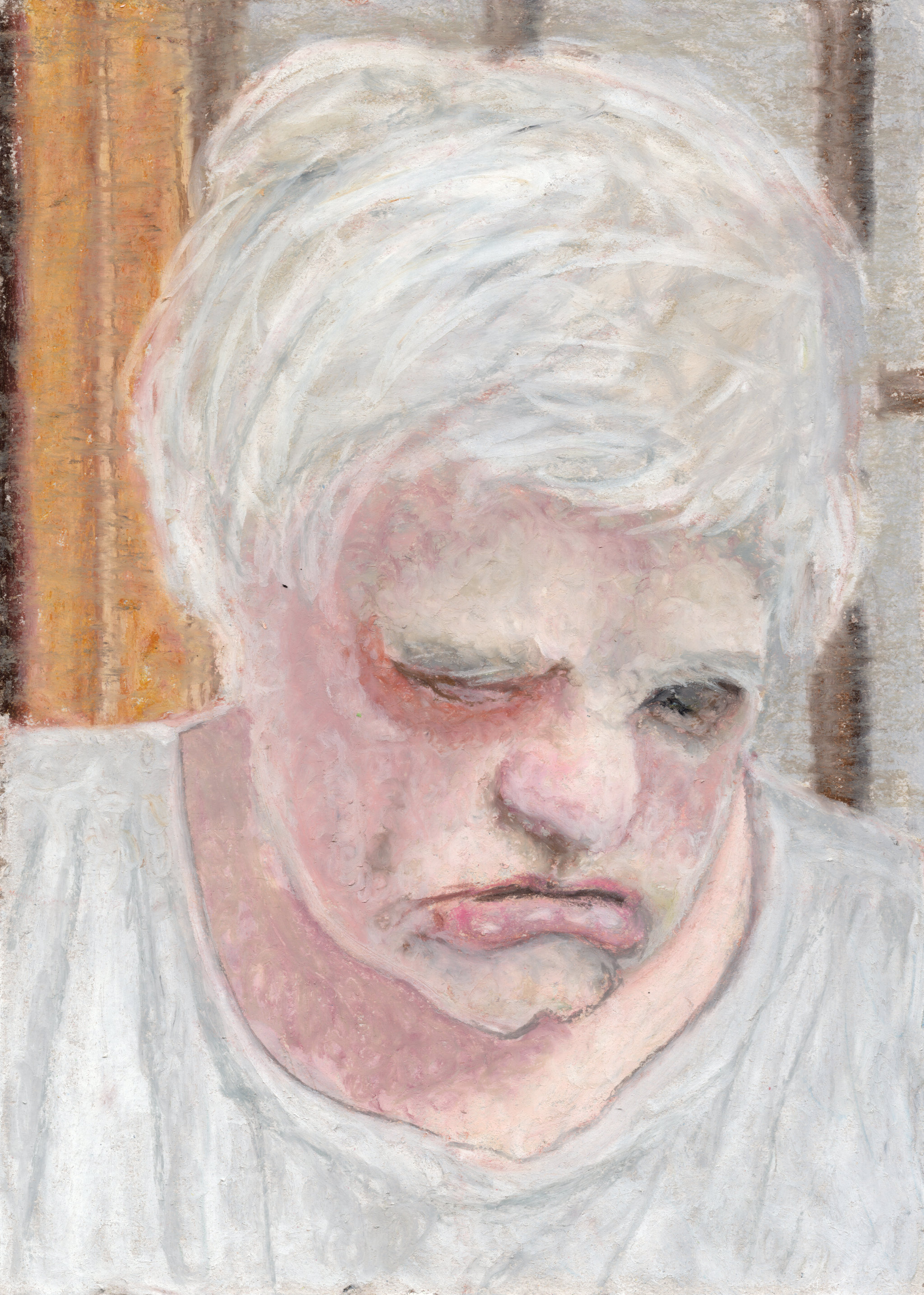 Brain-damaged woman