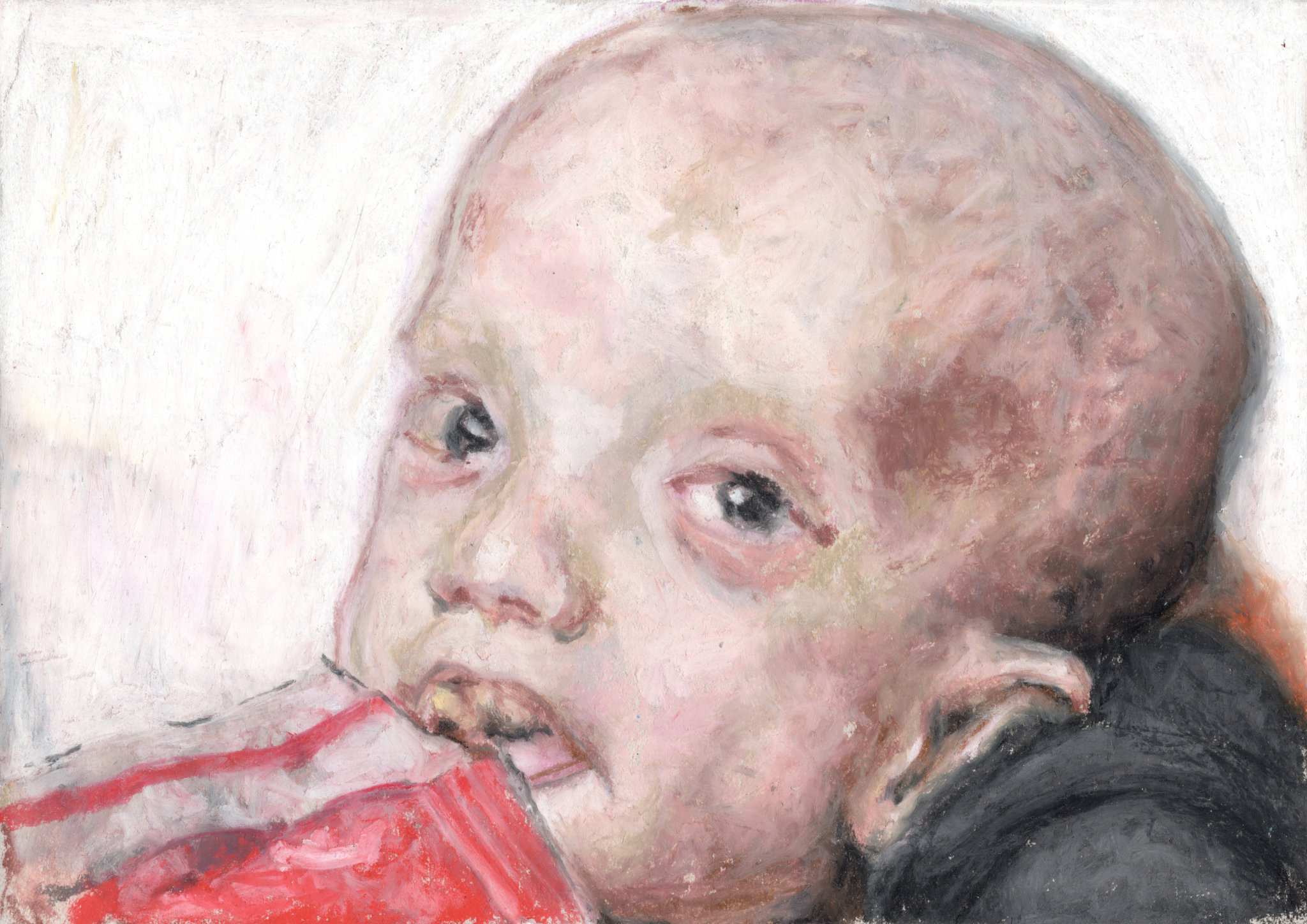 iPad / Malnourished boy