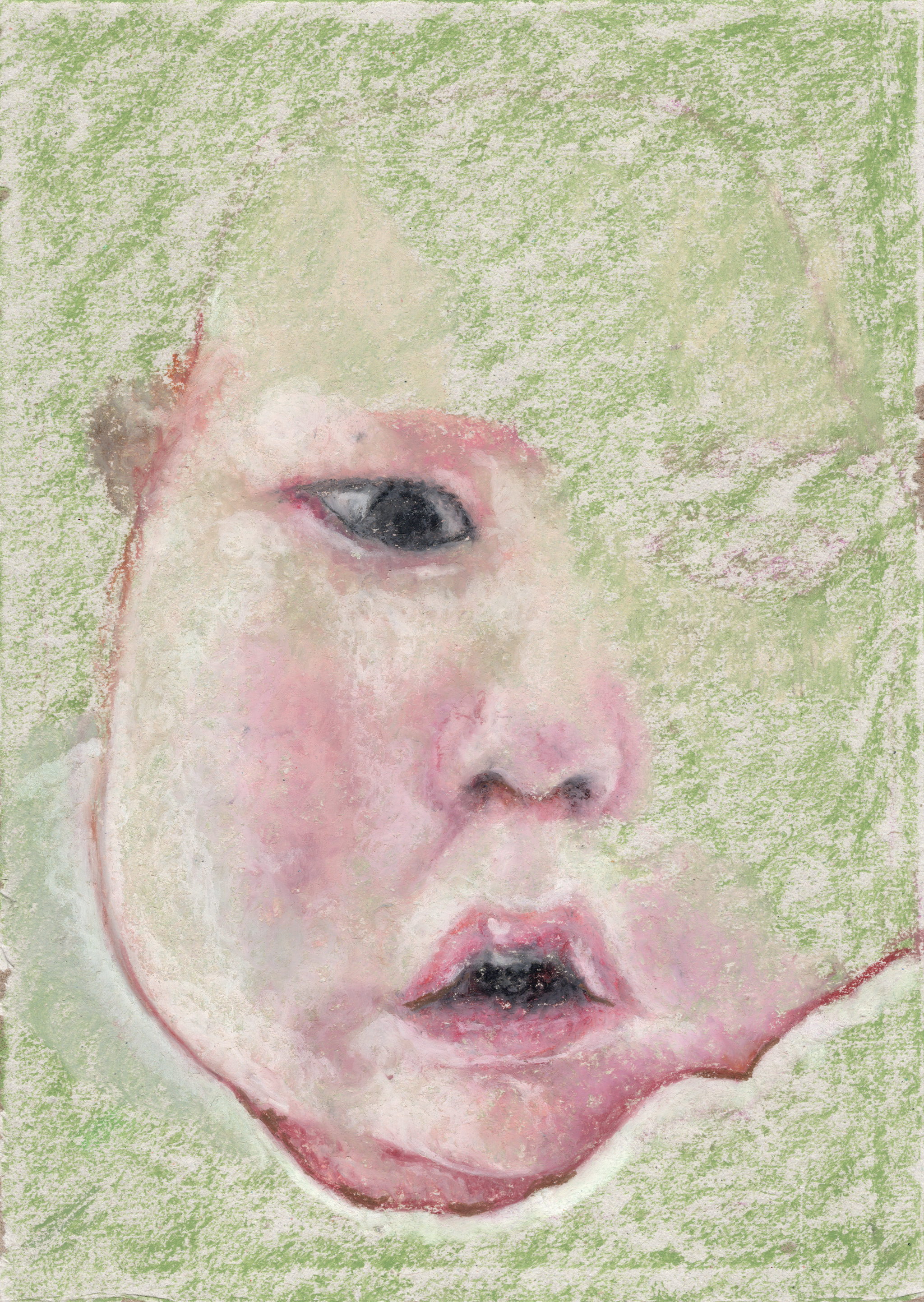Untitled / Girl / Cerebral damages